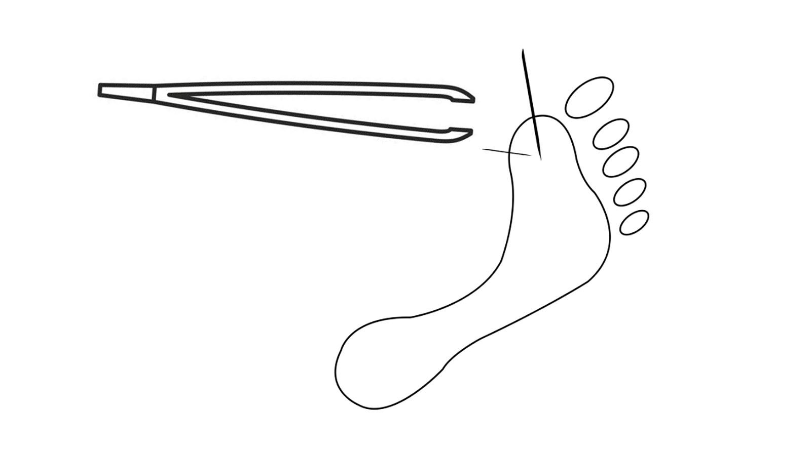Use tweezers first